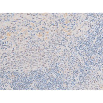 Phospho-LIMK2 (Ser283) Antibody in Immunohistochemistry (Paraffin) (IHC (P))