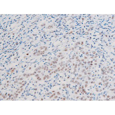 Phospho-LIMK2 (Ser283) Antibody in Immunohistochemistry (Paraffin) (IHC (P))