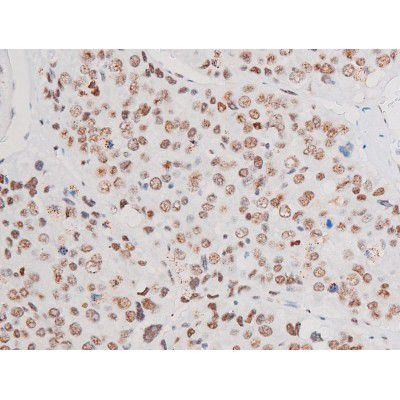 Phospho-LIMK2 (Ser283) Antibody in Immunohistochemistry (Paraffin) (IHC (P))