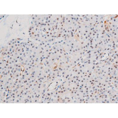 Phospho-LIMK2 (Ser283) Antibody in Immunohistochemistry (Paraffin) (IHC (P))