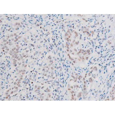 Phospho-LIMK2 (Ser283) Antibody in Immunohistochemistry (Paraffin) (IHC (P))