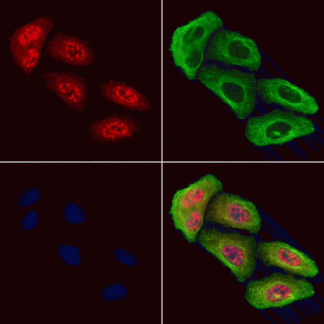 Phospho-HDAC4 (Ser632) Antibody in Immunocytochemistry (ICC/IF)