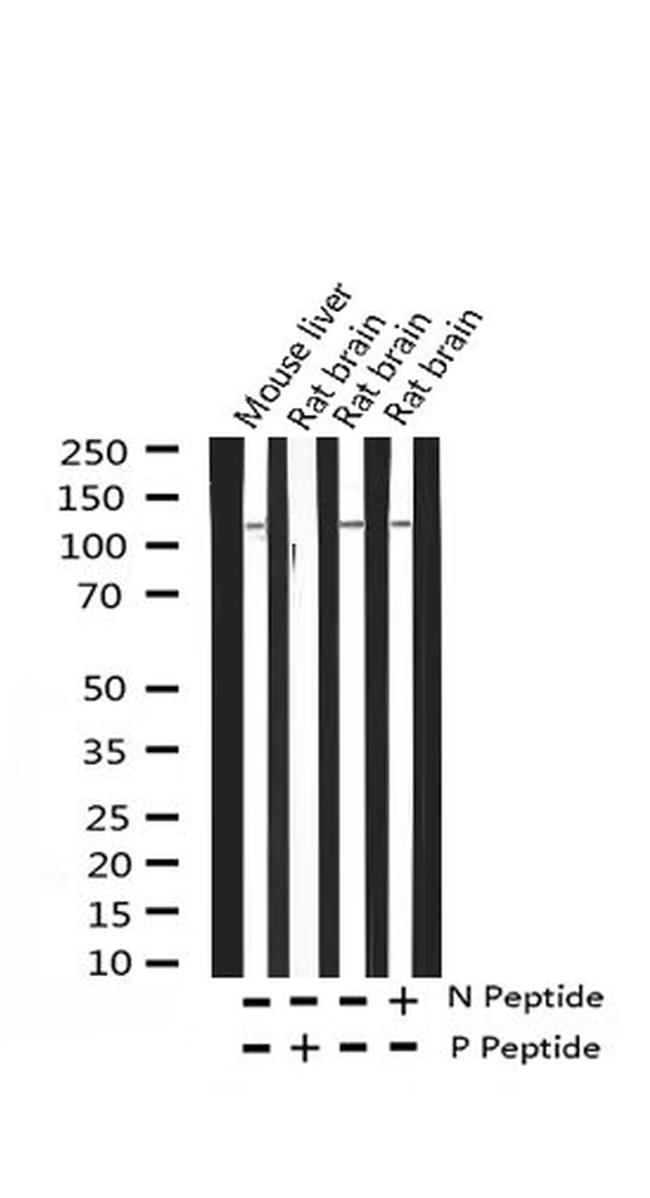 Phospho-HDAC4 (Ser632) Antibody in Western Blot (WB)