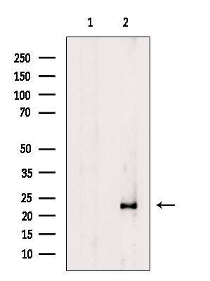 Phospho-RHOA (Ser188) Antibody in Western Blot (WB)