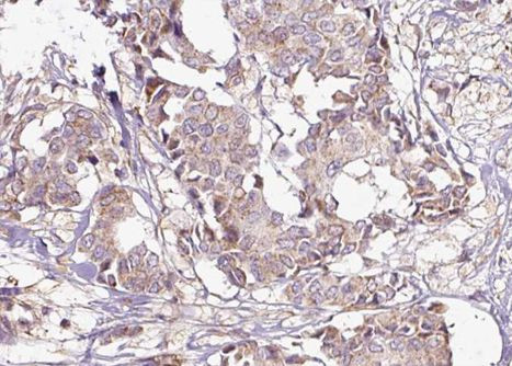 Phospho-14-3-3 zeta (Ser58) Antibody in Immunohistochemistry (Paraffin) (IHC (P))