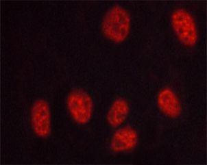 Phospho-DNA-PK (Thr2647) Antibody in Immunocytochemistry (ICC/IF)