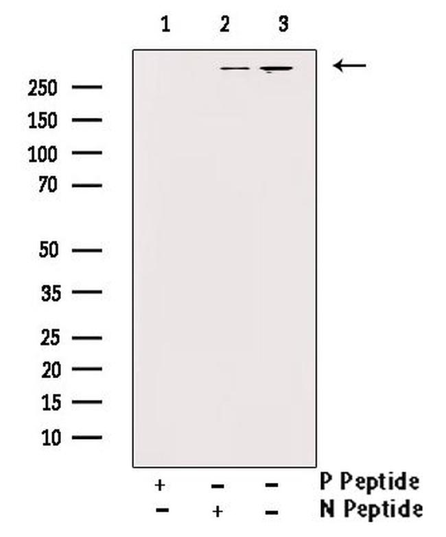 Phospho-DNA-PK (Thr2647) Antibody in Western Blot (WB)