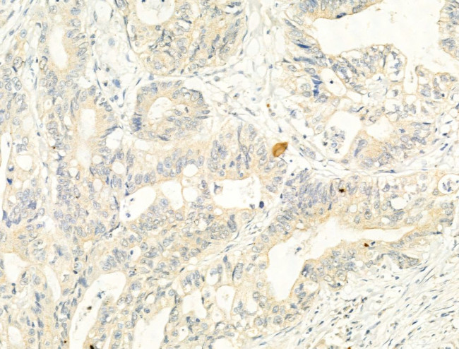 Phospho-ADAM17 (Thr735) Antibody in Immunohistochemistry (Paraffin) (IHC (P))