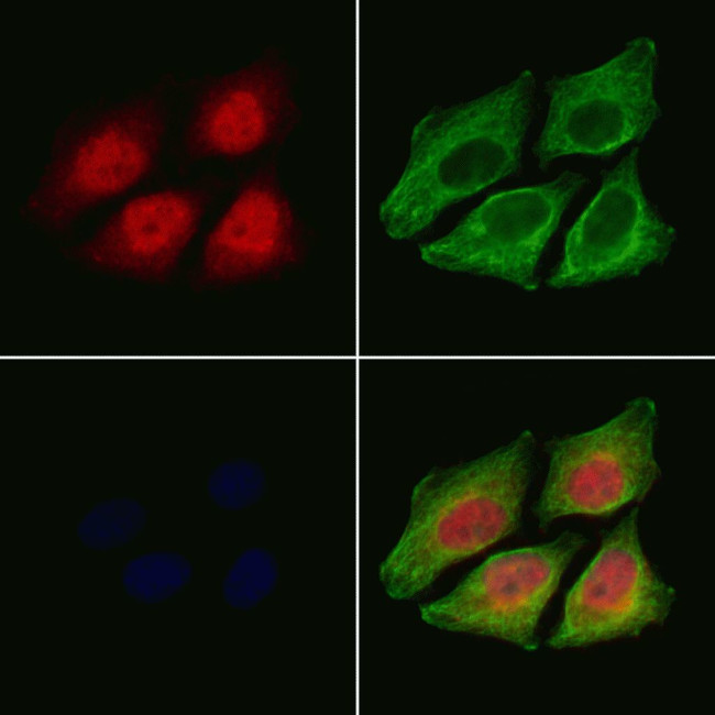 Phospho-Smad3 (Ser425) Antibody in Immunocytochemistry (ICC/IF)