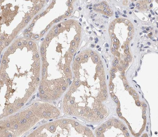 Phospho-Smad3 (Ser425) Antibody in Immunohistochemistry (Paraffin) (IHC (P))