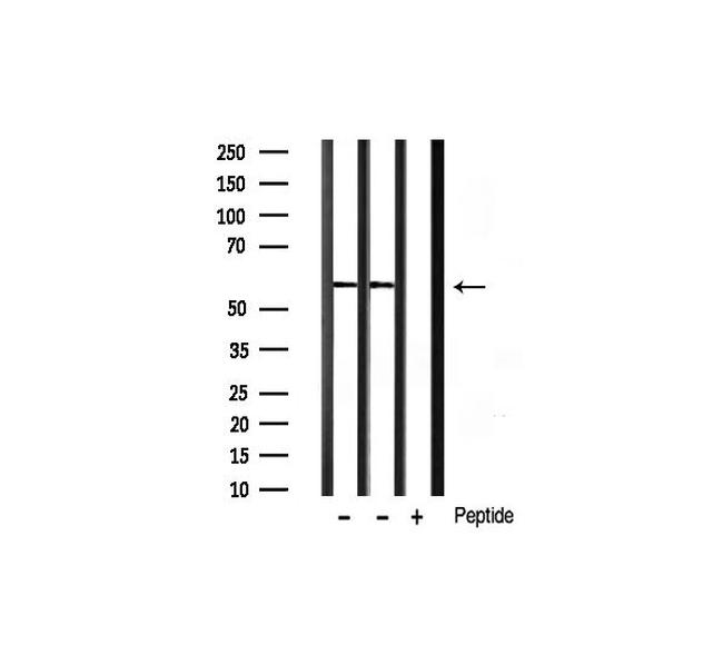 Phospho-Smad3 (Ser425) Antibody in Western Blot (WB)