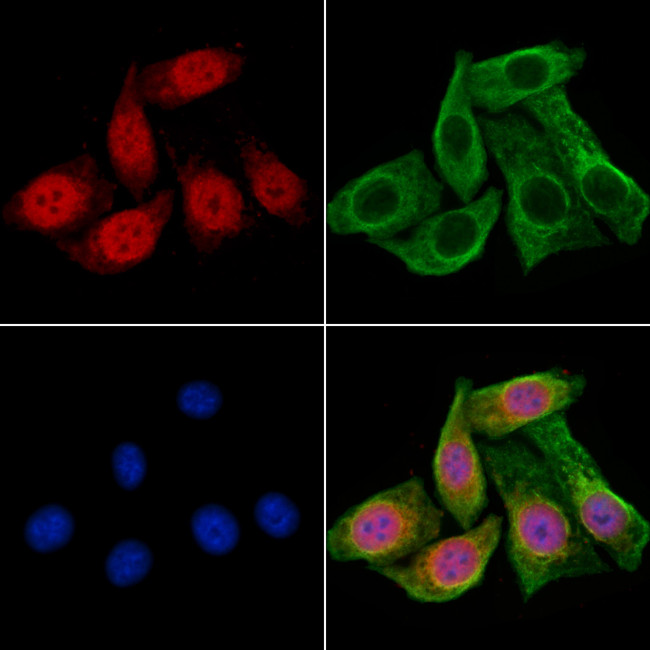 Phospho-Smad3 (Ser425) Antibody in Immunocytochemistry (ICC/IF)