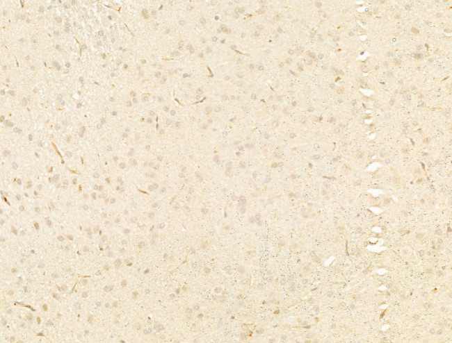 Phospho-Smad3 (Ser425) Antibody in Immunohistochemistry (Paraffin) (IHC (P))