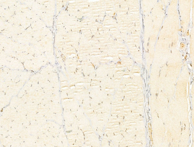 Phospho-Smad3 (Ser425) Antibody in Immunohistochemistry (Paraffin) (IHC (P))