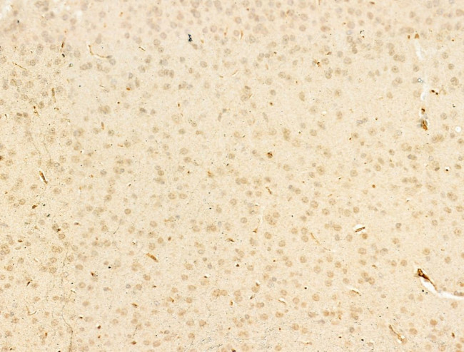 Phospho-Smad3 (Ser425) Antibody in Immunohistochemistry (Paraffin) (IHC (P))