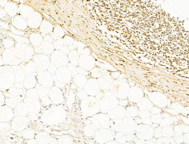 Phospho-Smad3 (Ser425) Antibody in Immunohistochemistry (Paraffin) (IHC (P))