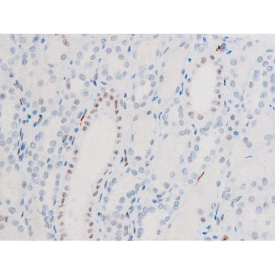 Phospho-FOXO4 (Thr451) Antibody in Immunohistochemistry (Paraffin) (IHC (P))