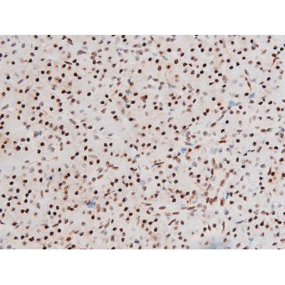 Phospho-FOXO4 (Thr451) Antibody in Immunohistochemistry (Paraffin) (IHC (P))