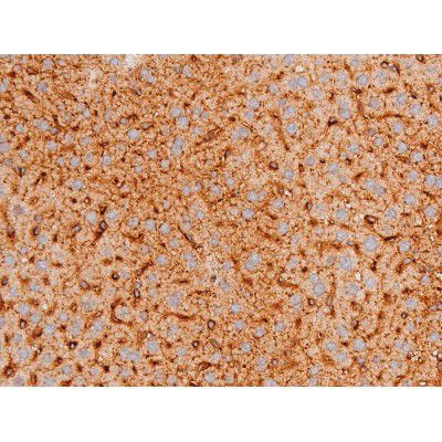 Phospho-FOXO4 (Thr451) Antibody in Immunohistochemistry (Paraffin) (IHC (P))