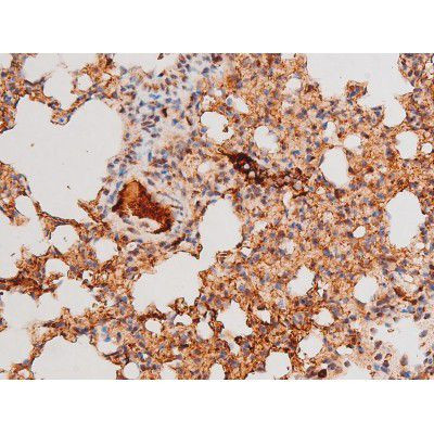 Phospho-FOXO4 (Thr451) Antibody in Immunohistochemistry (Paraffin) (IHC (P))