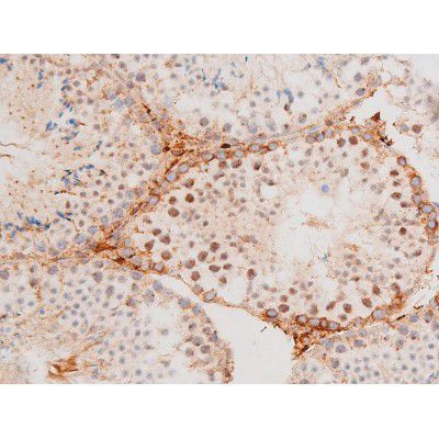 Phospho-FOXO4 (Thr451) Antibody in Immunohistochemistry (Paraffin) (IHC (P))