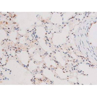 Phospho-FOXO4 (Thr451) Antibody in Immunohistochemistry (Paraffin) (IHC (P))