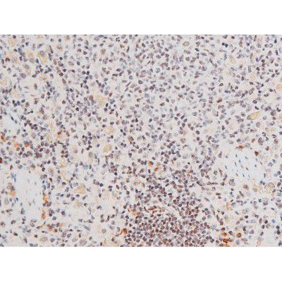 Phospho-FOXO4 (Thr451) Antibody in Immunohistochemistry (Paraffin) (IHC (P))