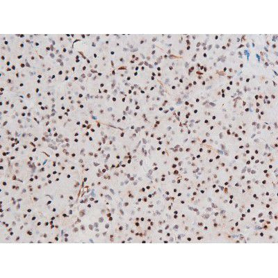 Phospho-FOXO4 (Thr451) Antibody in Immunohistochemistry (Paraffin) (IHC (P))