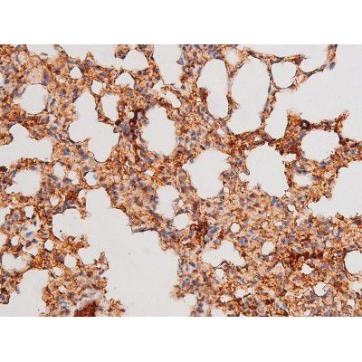 Phospho-FOXO4 (Thr451) Antibody in Immunohistochemistry (Paraffin) (IHC (P))