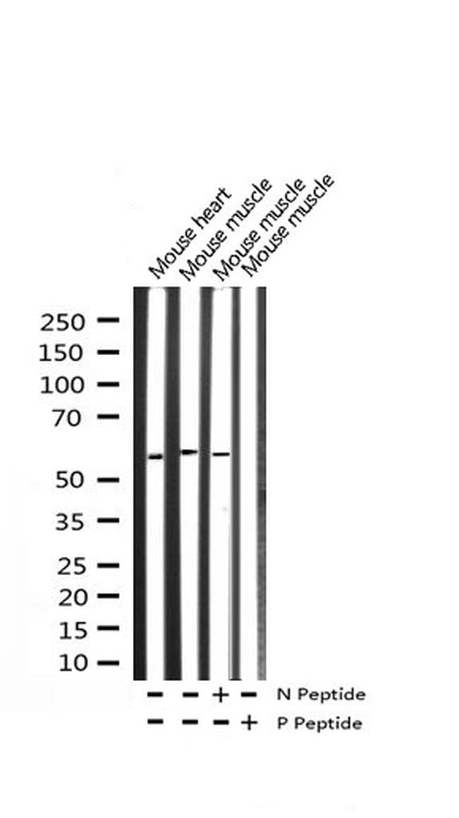 Phospho-FOXO4 (Thr451) Antibody in Western Blot (WB)