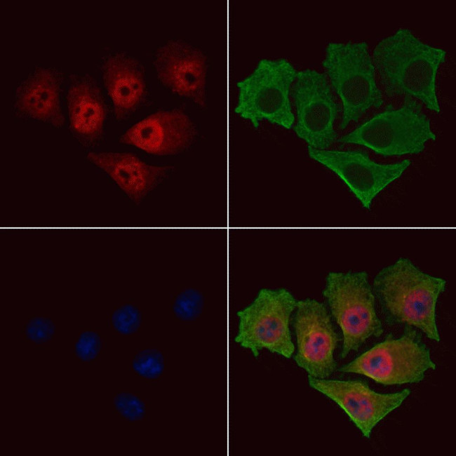 Phospho-NFkB p100 (Ser870) Antibody in Immunocytochemistry (ICC/IF)