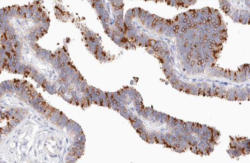 Phospho-NFkB p100 (Ser870) Antibody in Immunohistochemistry (Paraffin) (IHC (P))