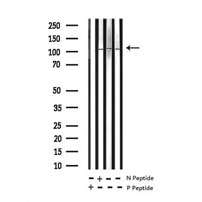 Phospho-NFkB p100 (Ser870) Antibody in Western Blot (WB)