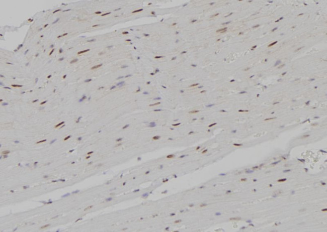 Phospho-RUNX1 (Ser304) Antibody in Immunohistochemistry (Paraffin) (IHC (P))