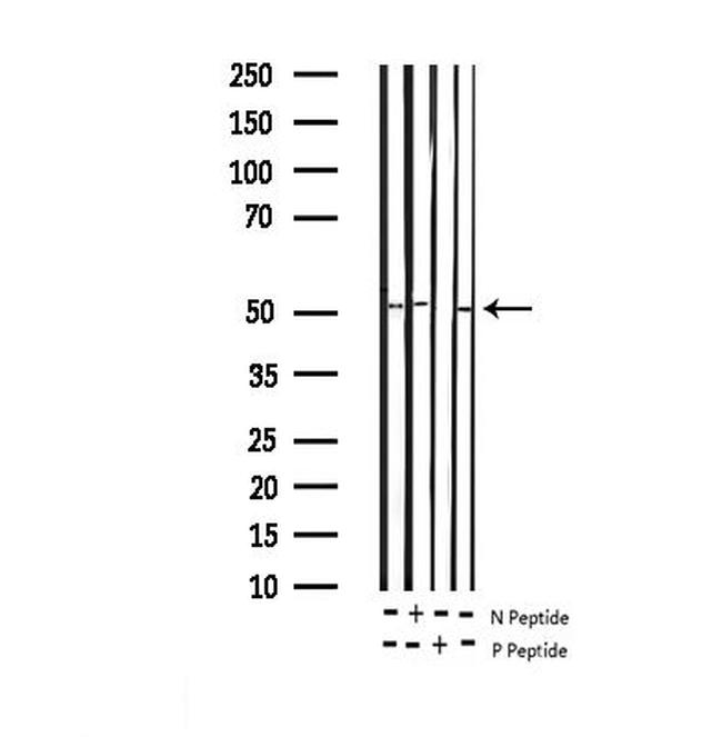 Phospho-RUNX1 (Ser304) Antibody in Western Blot (WB)