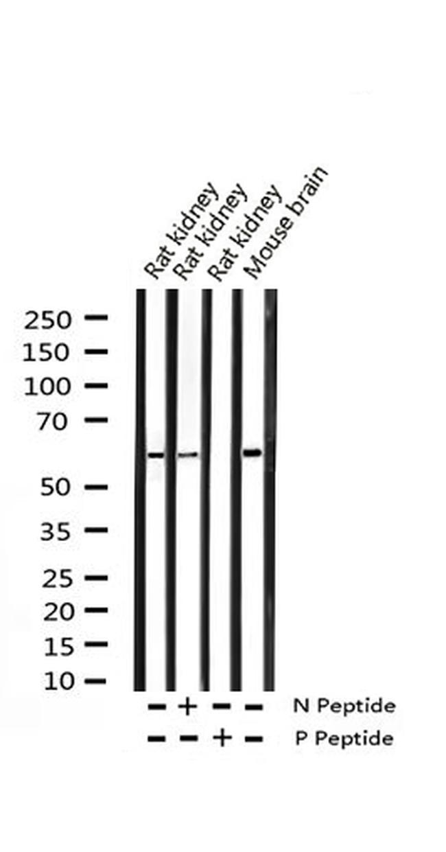 Phospho-MEF2A (Thr312) Antibody in Western Blot (WB)