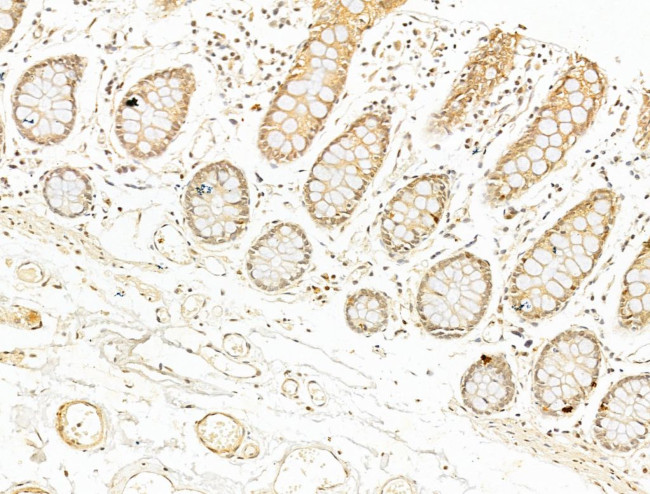 Phospho-NFkB p65 (Ser276) Antibody in Immunohistochemistry (Paraffin) (IHC (P))