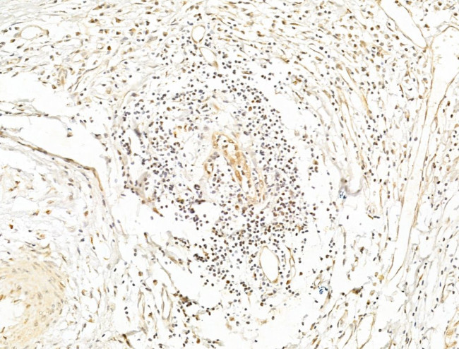 Phospho-NFkB p65 (Ser276) Antibody in Immunohistochemistry (Paraffin) (IHC (P))