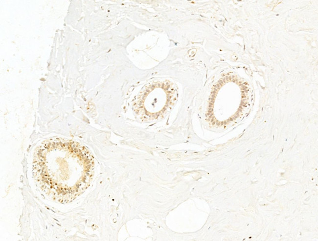 Phospho-NFkB p65 (Ser276) Antibody in Immunohistochemistry (Paraffin) (IHC (P))