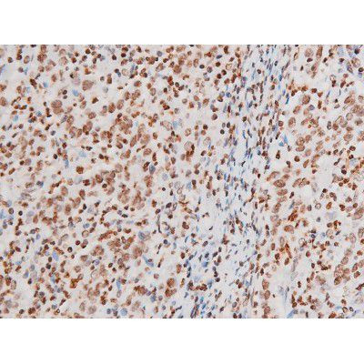 Phospho-NFkB p65 (Thr435) Antibody in Immunohistochemistry (Paraffin) (IHC (P))