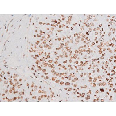 Phospho-NFkB p65 (Thr435) Antibody in Immunohistochemistry (Paraffin) (IHC (P))