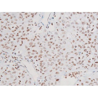 Phospho-NFkB p65 (Thr435) Antibody in Immunohistochemistry (Paraffin) (IHC (P))