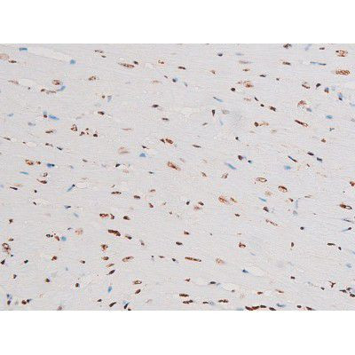 Phospho-NFkB p65 (Thr435) Antibody in Immunohistochemistry (Paraffin) (IHC (P))