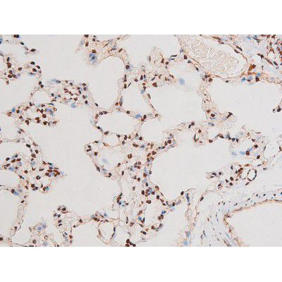 Phospho-NFkB p65 (Thr435) Antibody in Immunohistochemistry (Paraffin) (IHC (P))