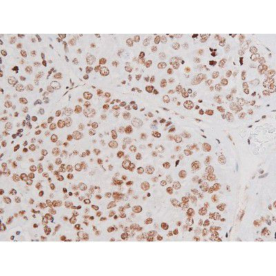 Phospho-NFkB p65 (Thr435) Antibody in Immunohistochemistry (Paraffin) (IHC (P))