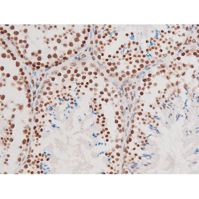 Phospho-NFkB p65 (Thr435) Antibody in Immunohistochemistry (Paraffin) (IHC (P))