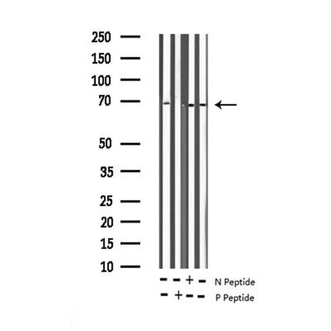 Phospho-NFkB p65 (Thr435) Antibody in Western Blot (WB)