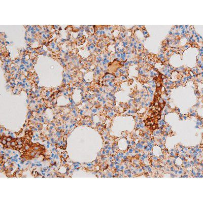 Phospho-Dynamin 1 (Ser774) Antibody in Immunohistochemistry (Paraffin) (IHC (P))