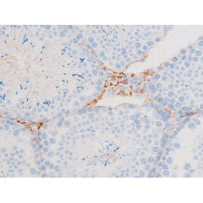 Phospho-Dynamin 1 (Ser774) Antibody in Immunohistochemistry (Paraffin) (IHC (P))