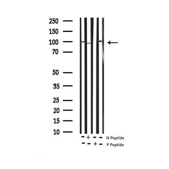 Phospho-Dynamin 1 (Ser774) Antibody in Western Blot (WB)